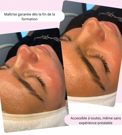 Formation Hydraskin en ligne